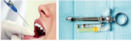 胰島素，牙科麻醉6.png